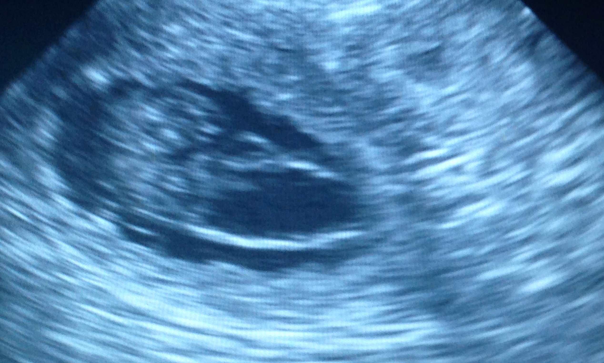 2014 06 03 Ultraschall G Wurf